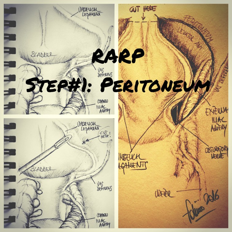 A0A9F3A9-A89C-4034-BD1D-610F75927B7C